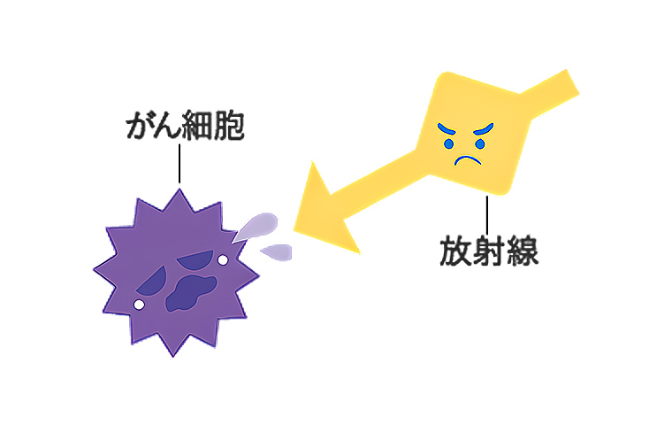 放射線治療ソリューション